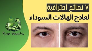 7 نصائح احترافية للتخلص من الهالات السوداء حول العينين