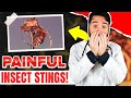 25 Most Painful Insect Stings In The World