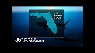3 people bitten by sharks at Florida beach