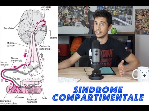 Video: Sindrome Compartimentale: Cause, Tipi E Sintomi