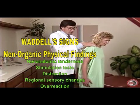 Waddell&rsquo;s Signs - A Screening Tool for Nonorganic Physical Findings