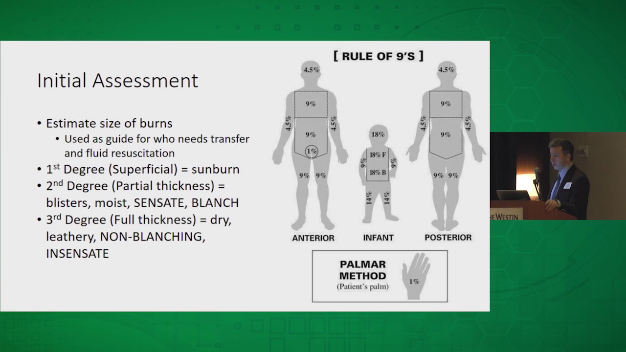 Initial Burn Management - YouTube