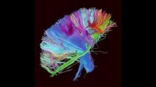 MUSE - Panic Station [The 2nd Law]