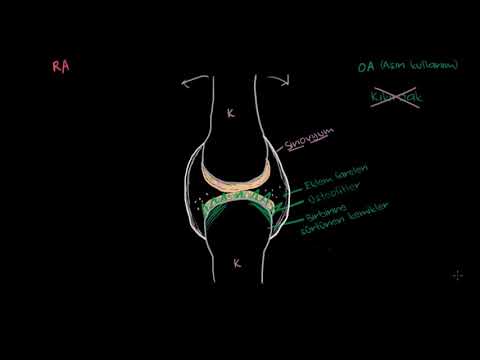 Osteoartrit ve Romatoid Artrit Patofizyolojisi (Fen Bilimleri) (Sağlık ve Tıp)