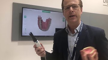 First Impressions with the new VATECH EZScan Intraoral Scanner!