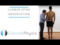 Lumbar Spine Observation | Clinical Physio