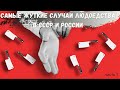 Самый жуткие случаи людоедства в СССР и России