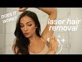 AT HOME LASER HAIR REMOVAL: MY EXPERIENCE! 🤔 FAQ + DEMO