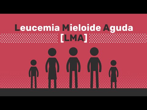 Resumen de la leucemia mieloide aguda