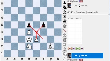 Improve Your Chess: What is a Backward Pawn? Not everyone agrees!