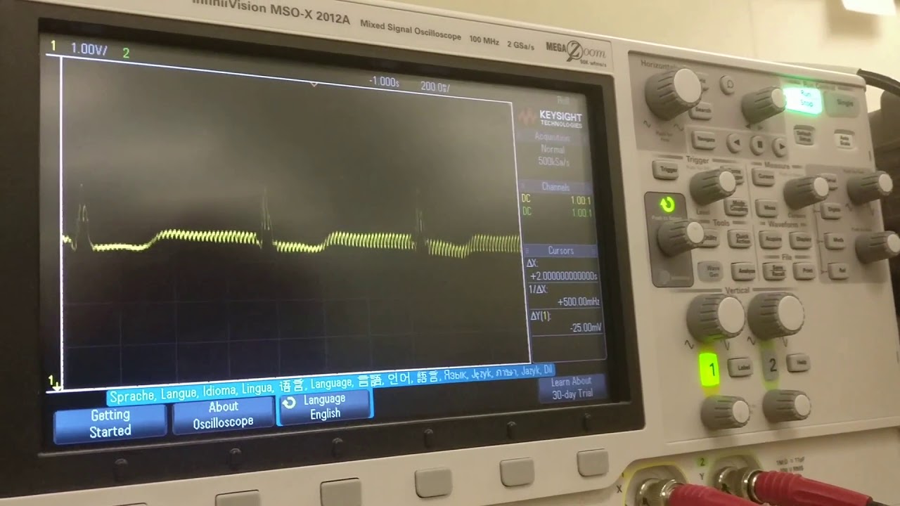 Analog ECG Data Sample - YouTube