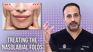 Treating The Nasolabial Folds Lesson Of The Day