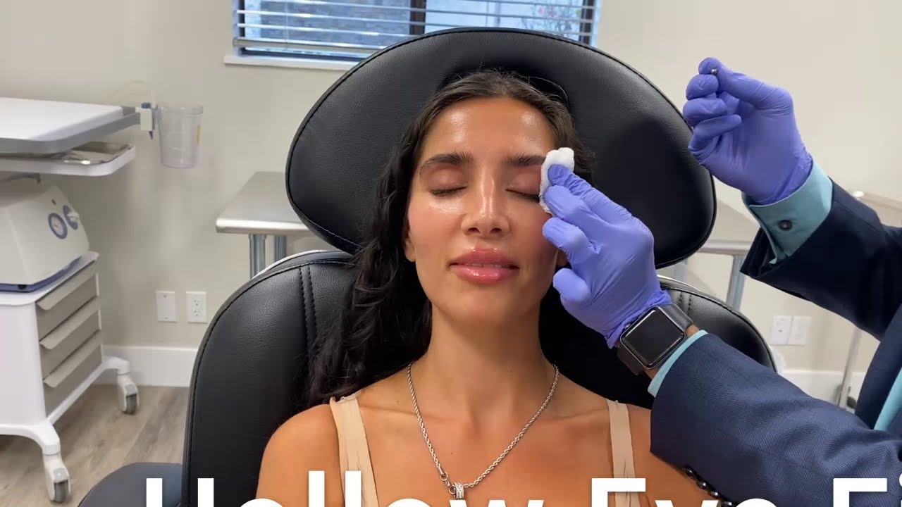 Dr. Sudeep Roy - Hollow Eye Filler