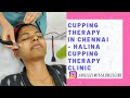 Cupping therapy in chennai  glowing skin secret