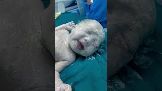 Newborn baby boy cleaning carefully ? ? ep223 babyvideotrend shortsfeed
