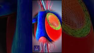 How Arteries, Veins, and Capillaries Work and Differ from Each Other