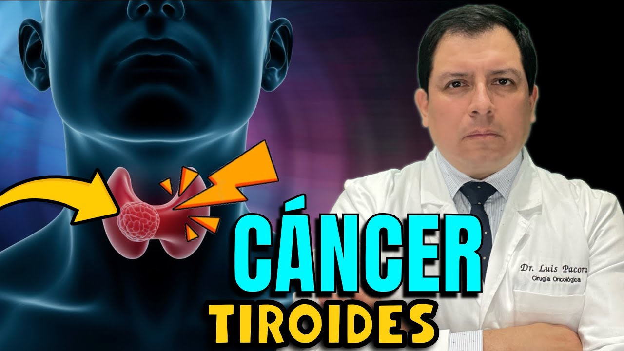 CUIDADO ⚠️  ¿CÁNCER DE TIROIDES?