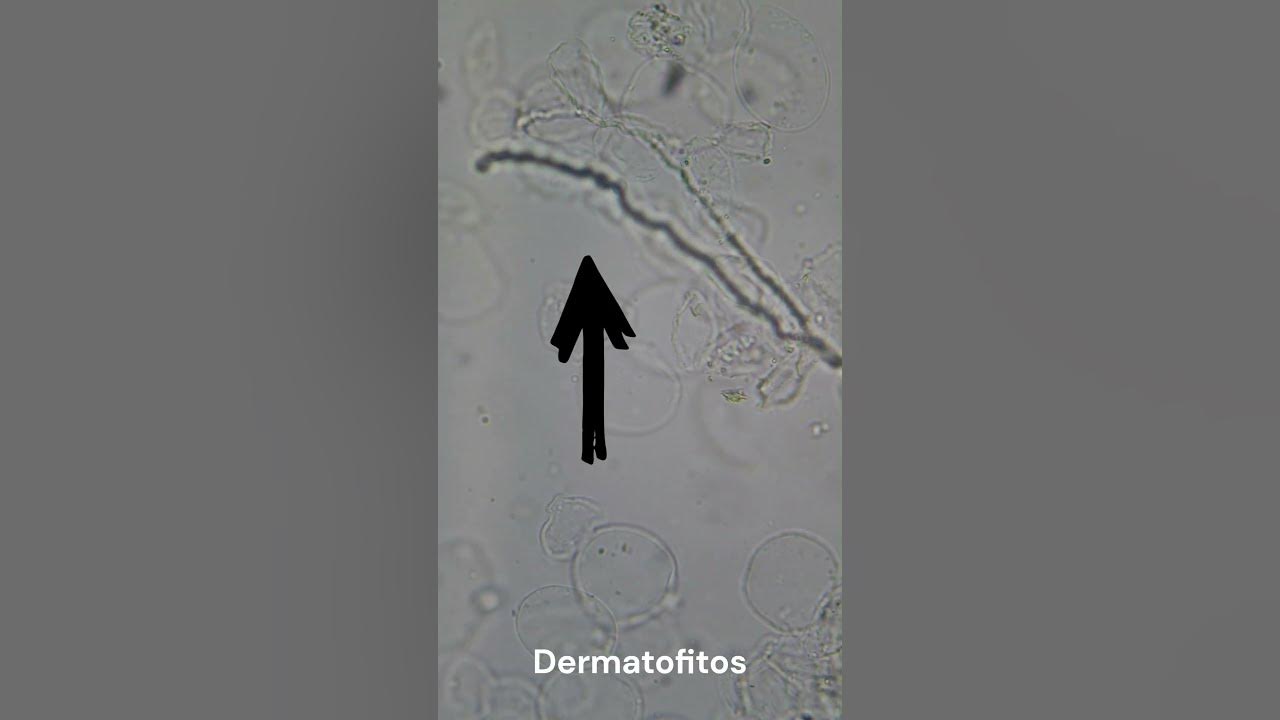 Así se ve el PIE DE ATLETA al microscopio laboratorioclinico shorts microbiology YouTube