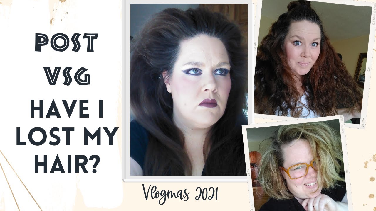 Have I lost my crazy thick hair after weight loss surgery? YouTube