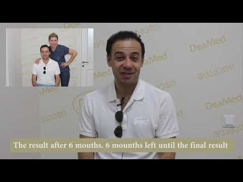 Deamed - თმის გადანერგვა - Hair Transplant
