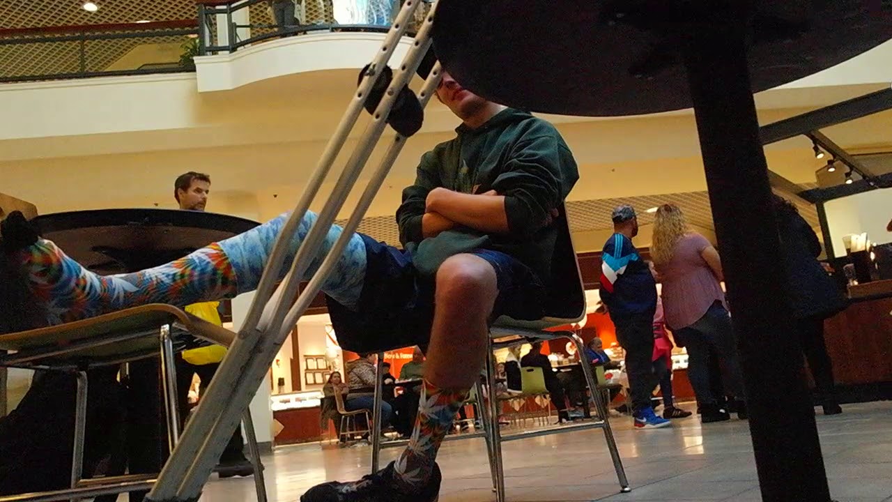 Grant's busted leg story