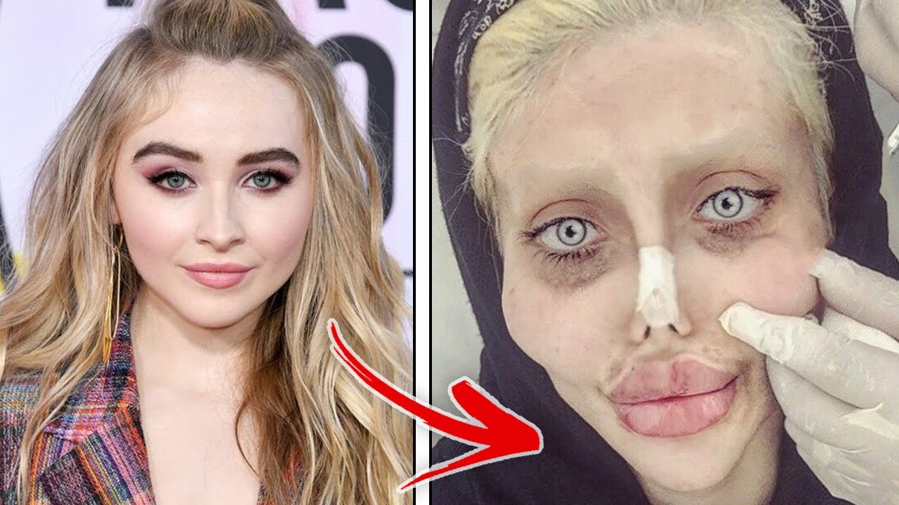 Celebrities Who Destroyed Their Face With Plastic Surgery YouTube