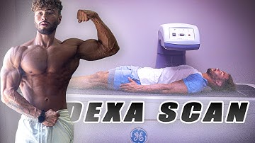 MY FIRST DEXA SCAN | TIME TO GROW EP. 1