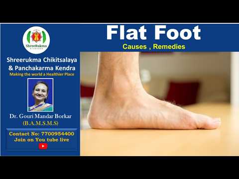 Flat Foot : Causes , Remedies