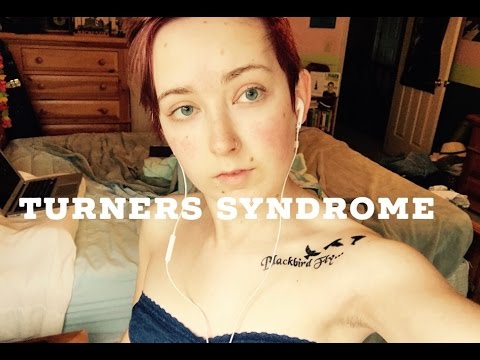 Video: Shereshevsky Turners Syndrom - Orsaker, Symtom Och Behandling