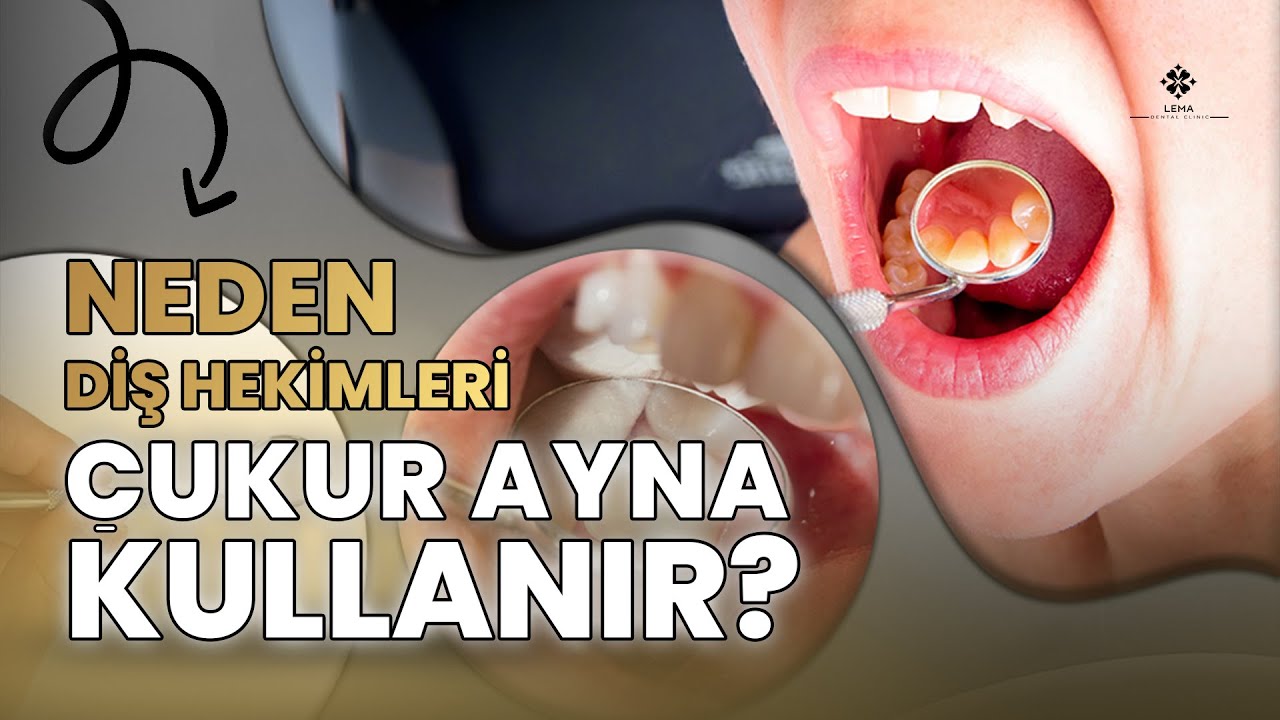 🤍 Зачем стоматологи используют вогнутые зеркала? Объяснение экспертов -  клиника Lema