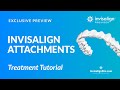 Attachments with Invisalign