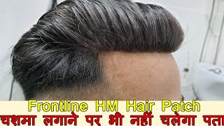 Hair Patch in Delhi | Frontline HM5 Hair Patch with Comfort Look in India by Planet of Hair Cloning