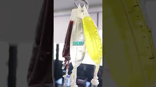 Why do many Patients prefer Stem Cells over Traditional Medicine