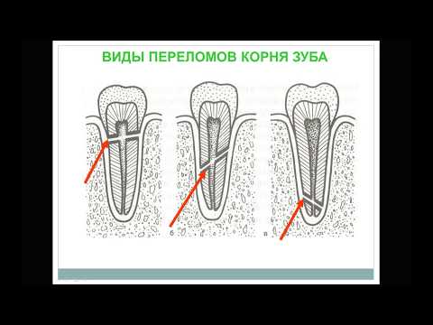 Лекция №7: Поражения зубов некариозного происхождения возникающие после прорезывания зубов.