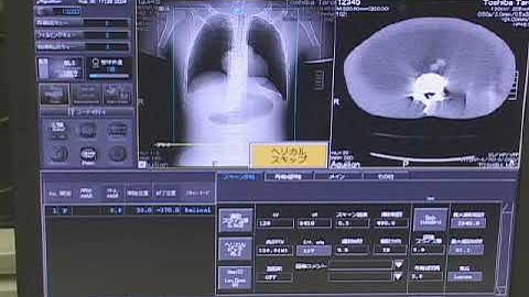 Toshiba Aquilion CT Scanner: Mastering the Main Menu 🚀🔍