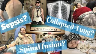 Vlogging With EDS: WHAT THE HECK HAPPENED TO ME? Fusion, Sepsis, and a collapsed lung| Week 109-112