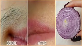 Only 1 onion get rid of facial hair permanently fast / unwanted hair removal permanent quickly screenshot 2