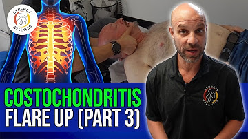 Costochondritis FLARE UP (Part - 3)