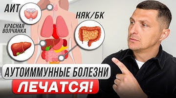 СПОСОБ ВЫЛЕЧИТЬ АУТОИММУНЫЕ БОЛЕЗНИ?  Стволовые клетки спасли мне жизнь (НЯК, Крон, АИГ, ПБХ , РА)