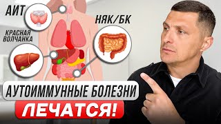 Моя борьба с аутоиммунным заболеванием: Как стволовые клетки спасли мне жизнь (НЯК, Крон, АИГ, ПБХ )