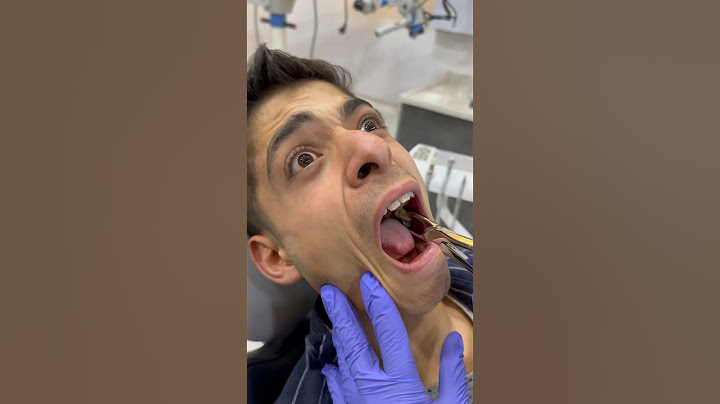 اغبى مريض عند دكتور الأسنان🦷😂نزار الحموي#shorts
