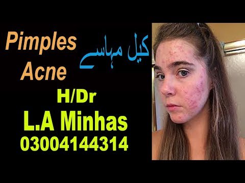 Pimples Acne Pathology Causes Symptoms & Homoeopathy with Ahmad / urdu hindi /