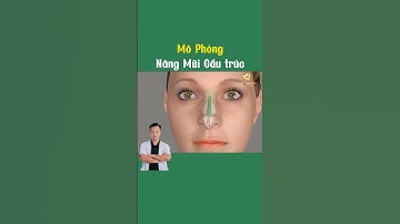 Mô phỏng nâng mũi cấu trúc | Bác sĩ Trọng #shots #pttm