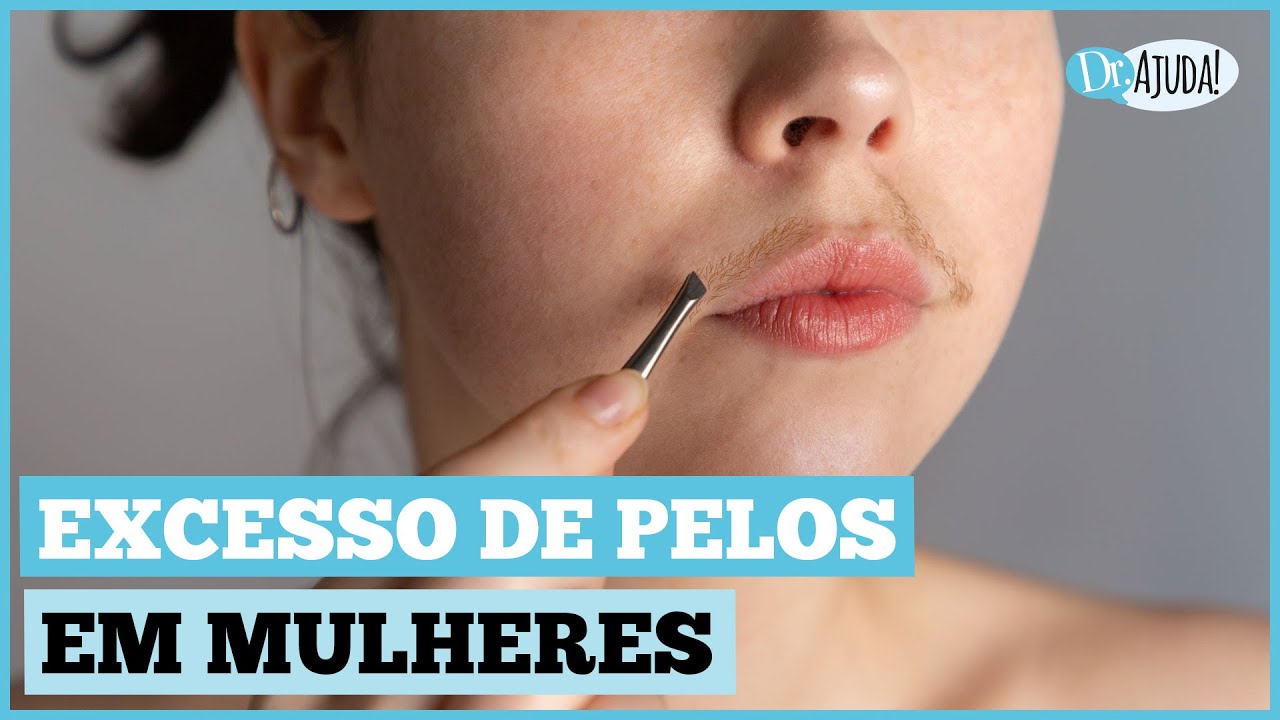 EXCESSO DE PELOS (HIRSUTISMO): O QUE FAZER?