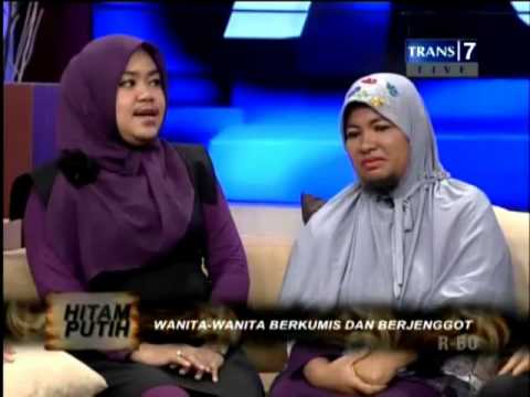  Hitam  Putih  Wanita  Berjenggot dan Berkumis Part 1 YouTube