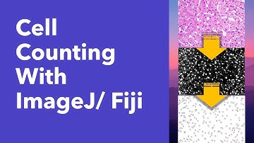 Cell/ particle counting with ImageJ