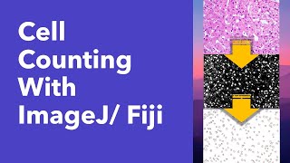 Cell/ particle counting with ImageJ