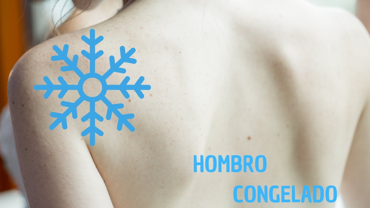 Hombro congelado causas emocionales