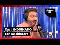 El DESASTRE estético de Xavi Rodríguez para la boda de Jose Manicas | Las Mañanas KISS #skincare