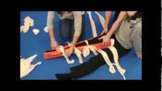 Splinting Lower Leg Fracture